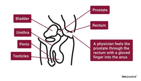 how to check prostate at home